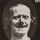 Image for article titled Terrifying, Century-Old Photographs from Neuroscience Experiments
